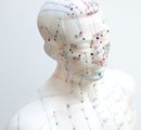 acupuncture-blog2