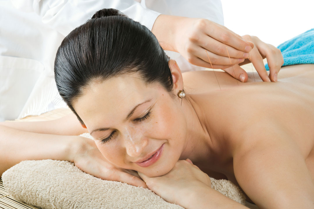 Electroacupuncture