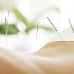 Magnetic Stimulation