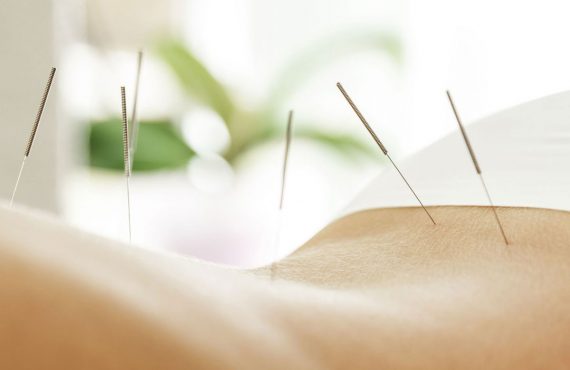 Magnetic Stimulation