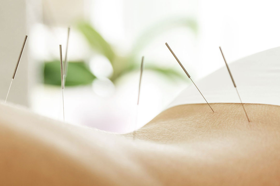 Magnetic Stimulation