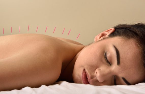 Moxibustion