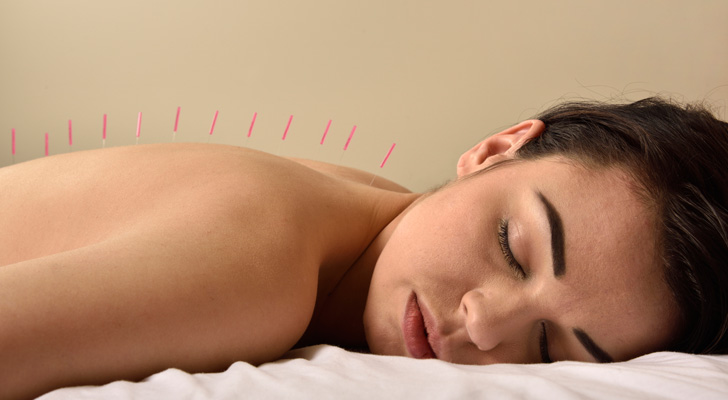 Moxibustion