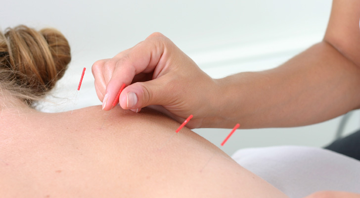 Chinese Moxibustion