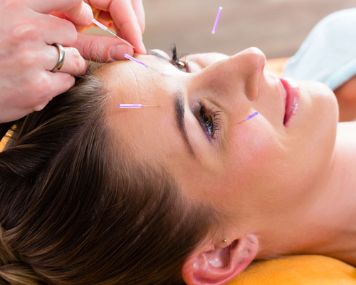 Headaches Treatments $45