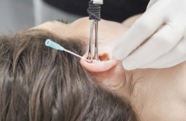 What Do They Mean For Your Dental Health