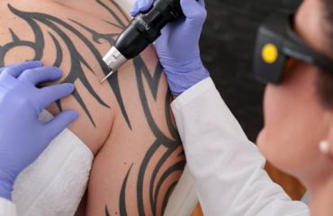 Where you want tattoo
