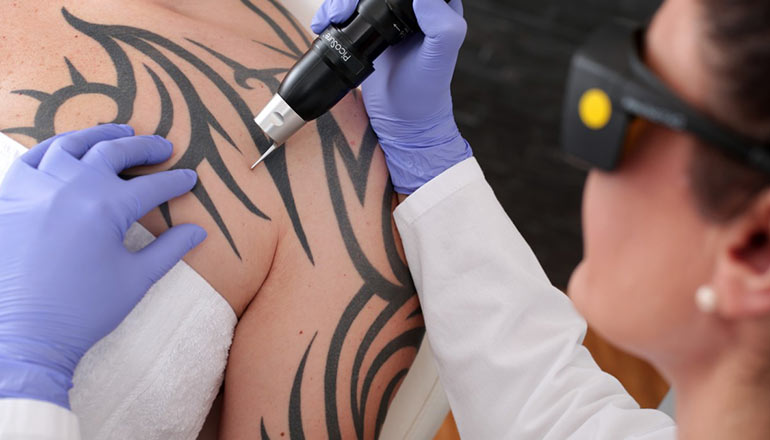 Where you want tattoo