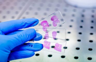 Rapid 4-D Imaging Focused on Protein Folding