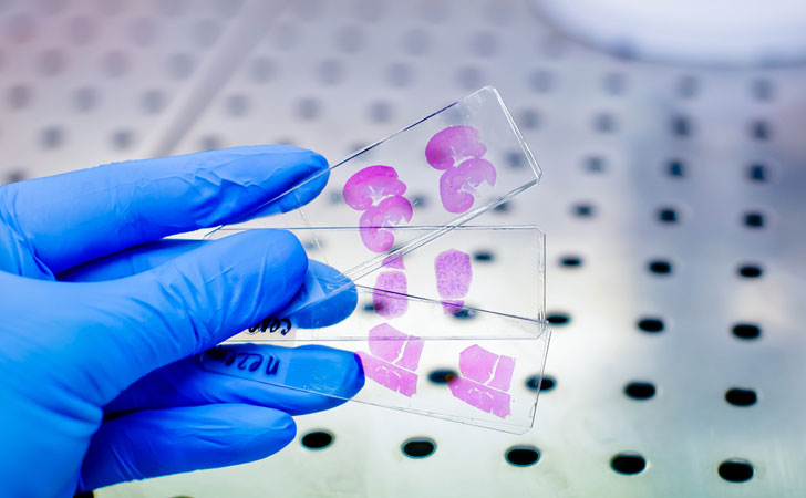 Rapid 4-D Imaging Focused on Protein Folding