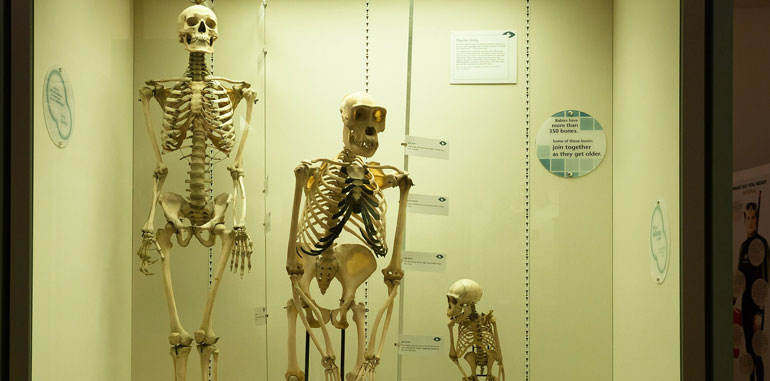 Skeleton difference